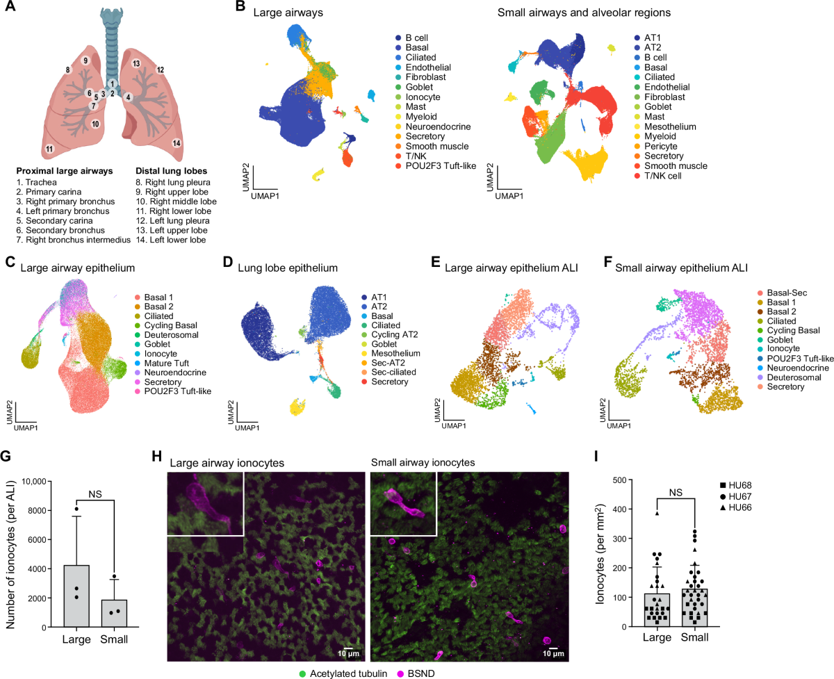 Single cell profiling of human airway identifies tuft-ionocyte progenitor  cells displaying cytokine-dependent differentiation bias in vitro | Nature  Communications
