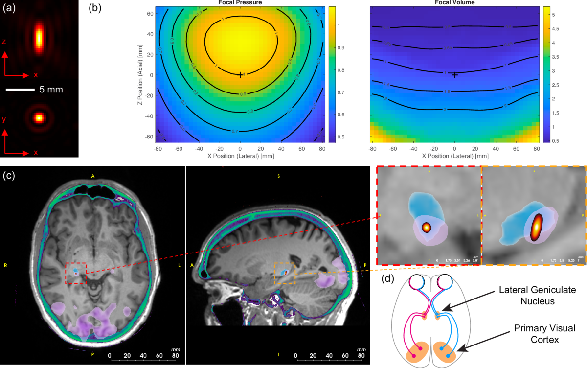 Ultrasound system for precise neuromodulation of human deep brain circuits  | Nature Communications