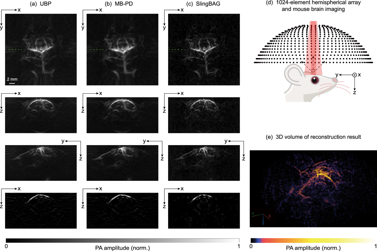 SlingBAG: point cloud-based iterative algorithm for large-scale 3D  photoacoustic imaging | Nature Communications