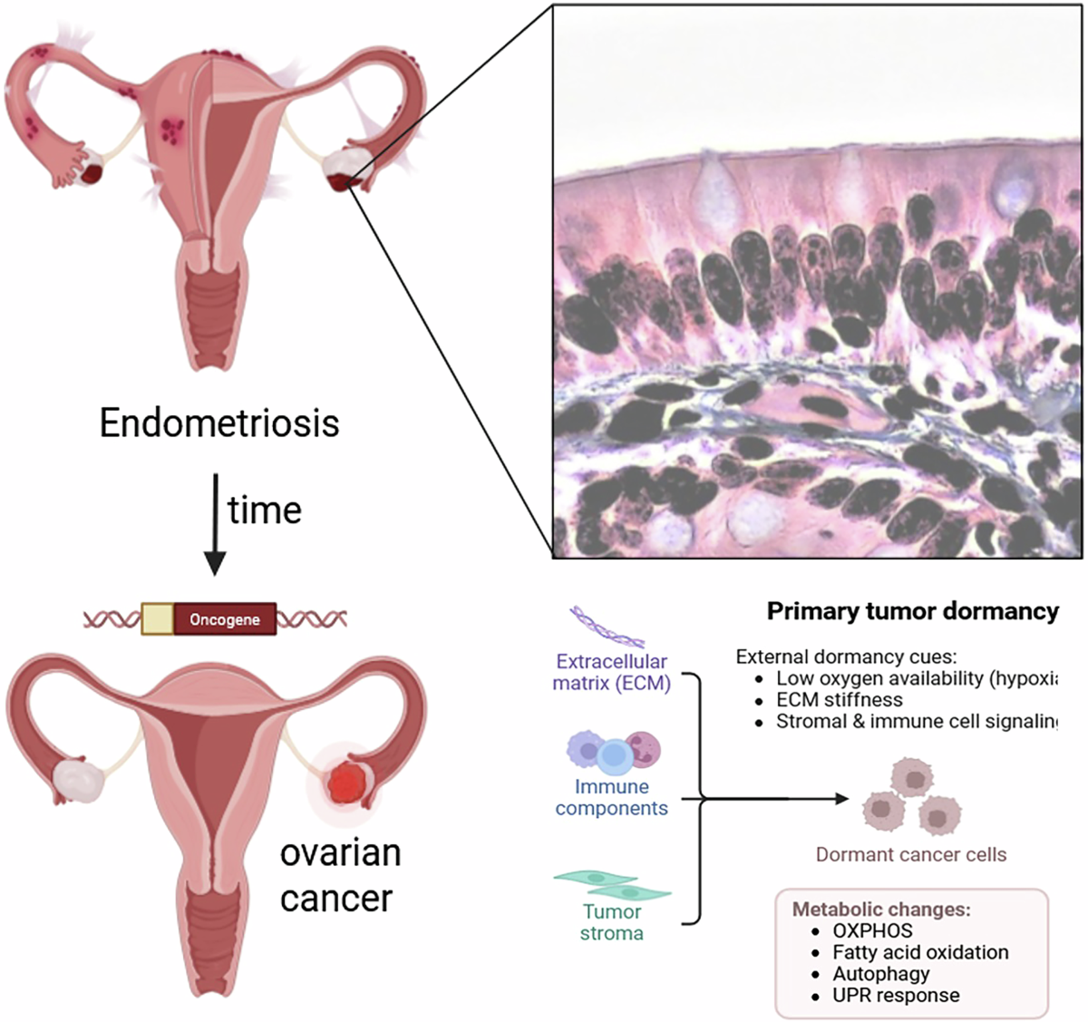 semaglutide and ovarian cancer Sirtuins and their role in ovarian aging-related fibrosis predisposing to ovarian  cancer