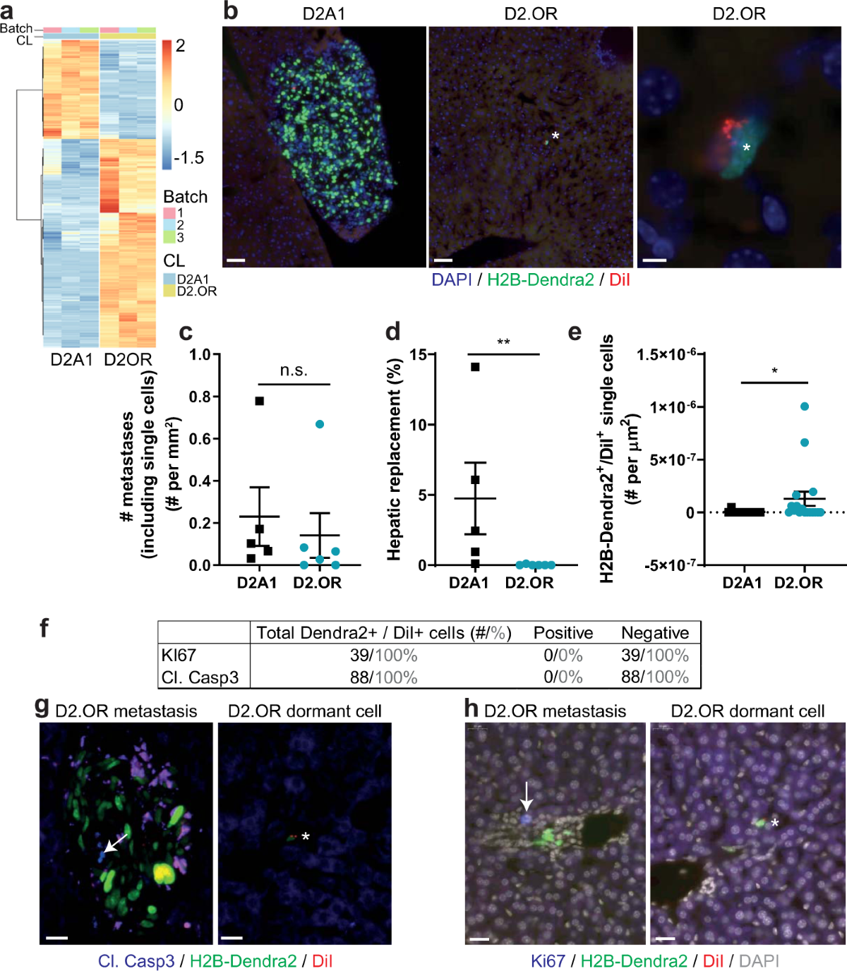 Breast cancer dormancy is associated with a 4NG1 state and not senescence |  npj Breast Cancer