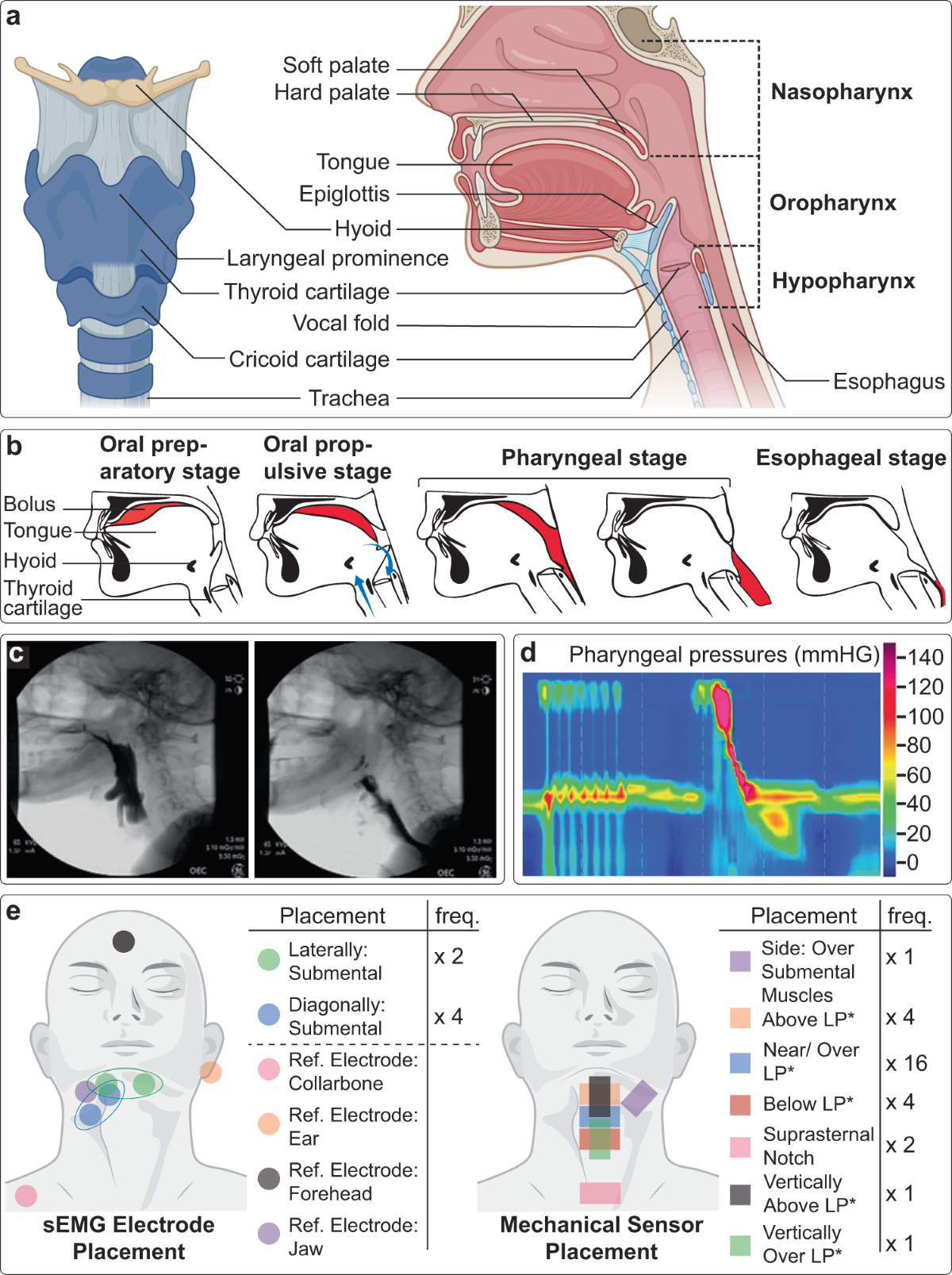 Wearable, epidermal devices for assessment of swallowing function | npj Flexible Electronics wearable-epidermal-devices-for-assessment-of-swallowing-function-npj-flexible-electronics