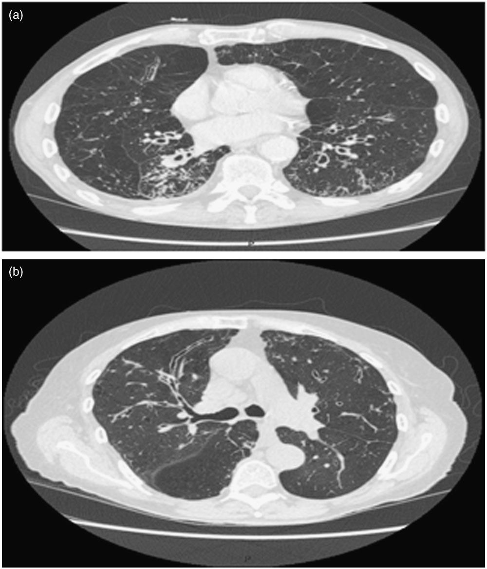 Frontiers | Internal organs and body tissues of free-swimming whale sharks  (Rhincodon typus) imaged using underwater ultrasound, image size:1000x1168