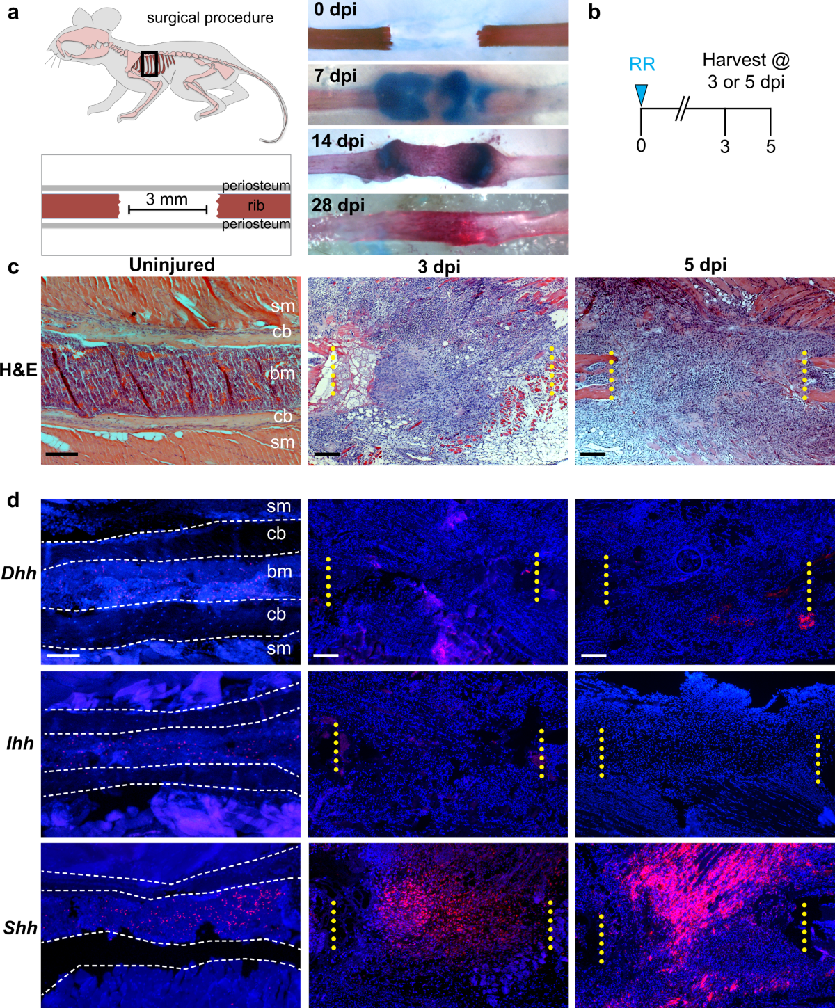 A murine model of large-scale bone regeneration reveals a selective  requirement for Sonic Hedgehog | npj Regenerative Medicine