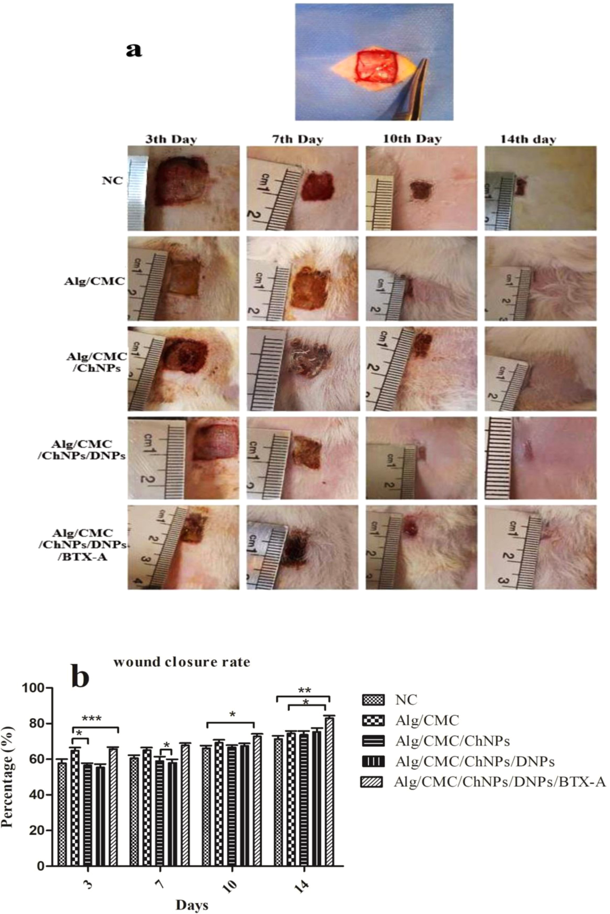 chitosan and alginate wound dressings a short review A functional chitosan-based hydrogel as a wound dressing and drug delivery system in the treatment of wound healing