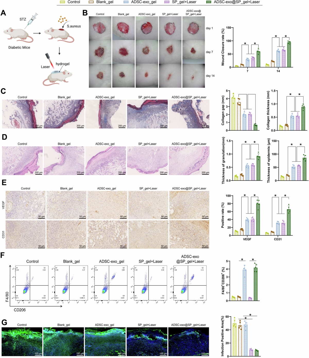 Novel approach for diabetic wound healing: adipose-derived mesenchymal  stromal cells Exo@SPHydrogel combined with laser therapy