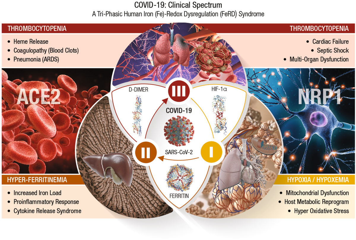 Precision nutrition to reset virus-induced human metabolic reprogramming  and dysregulation (HMRD) in long-COVID