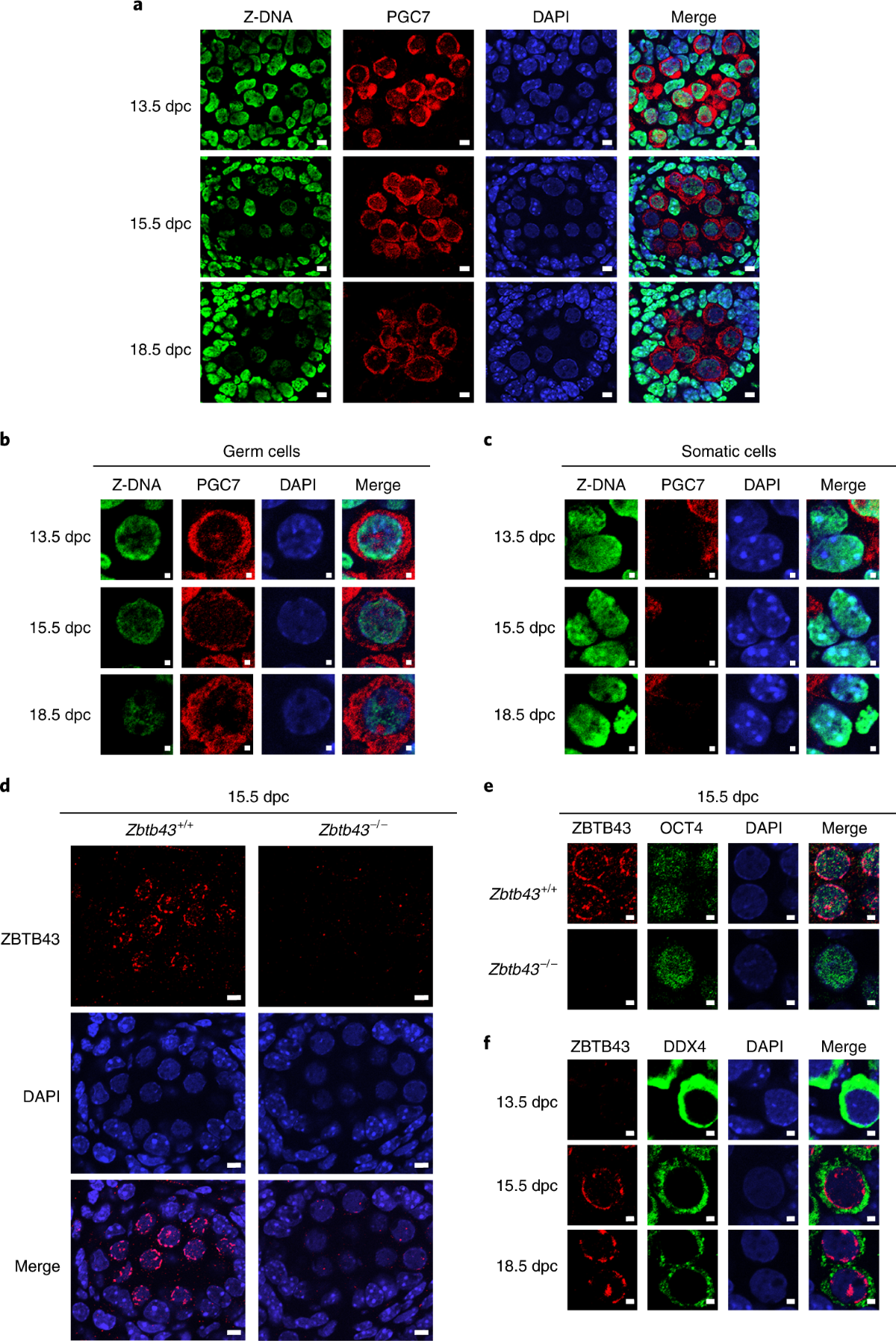 Z-DNA is remodelled by ZBTB43 in prospermatogonia to safeguard the germline genome and epigenome | Nature Cell Biology z-dna-is-remodelled-by-zbtb43-in-prospermatogonia-to-safeguard-the-germline-genome-and-epigenome-nature-cell-biology