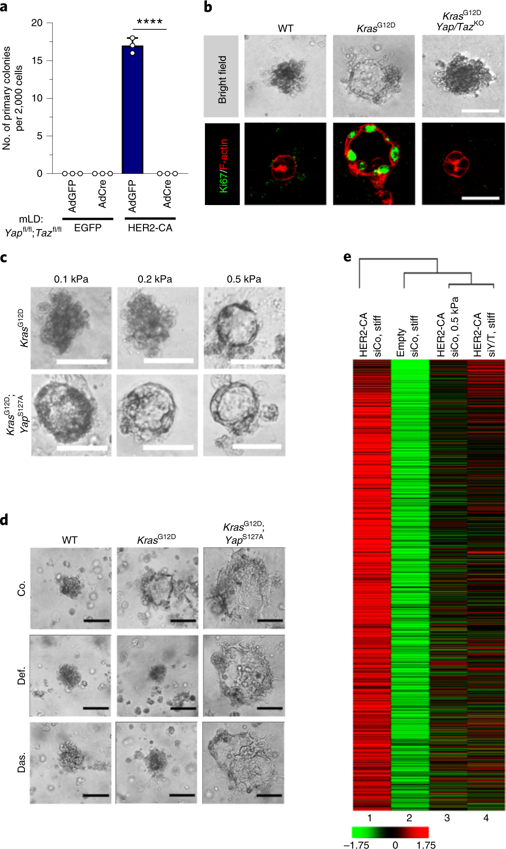 Reprogramming normal cells into tumour precursors requires ECM stiffness  and oncogene-mediated changes of cell mechanical properties | Nature  Materials
