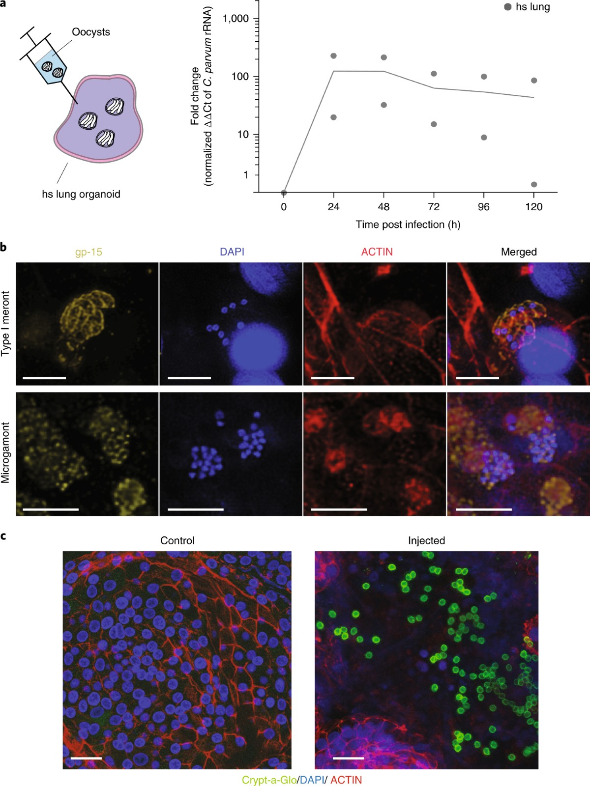 Modelling Cryptosporidium infection in human small intestinal and lung  organoids | Nature Microbiology
