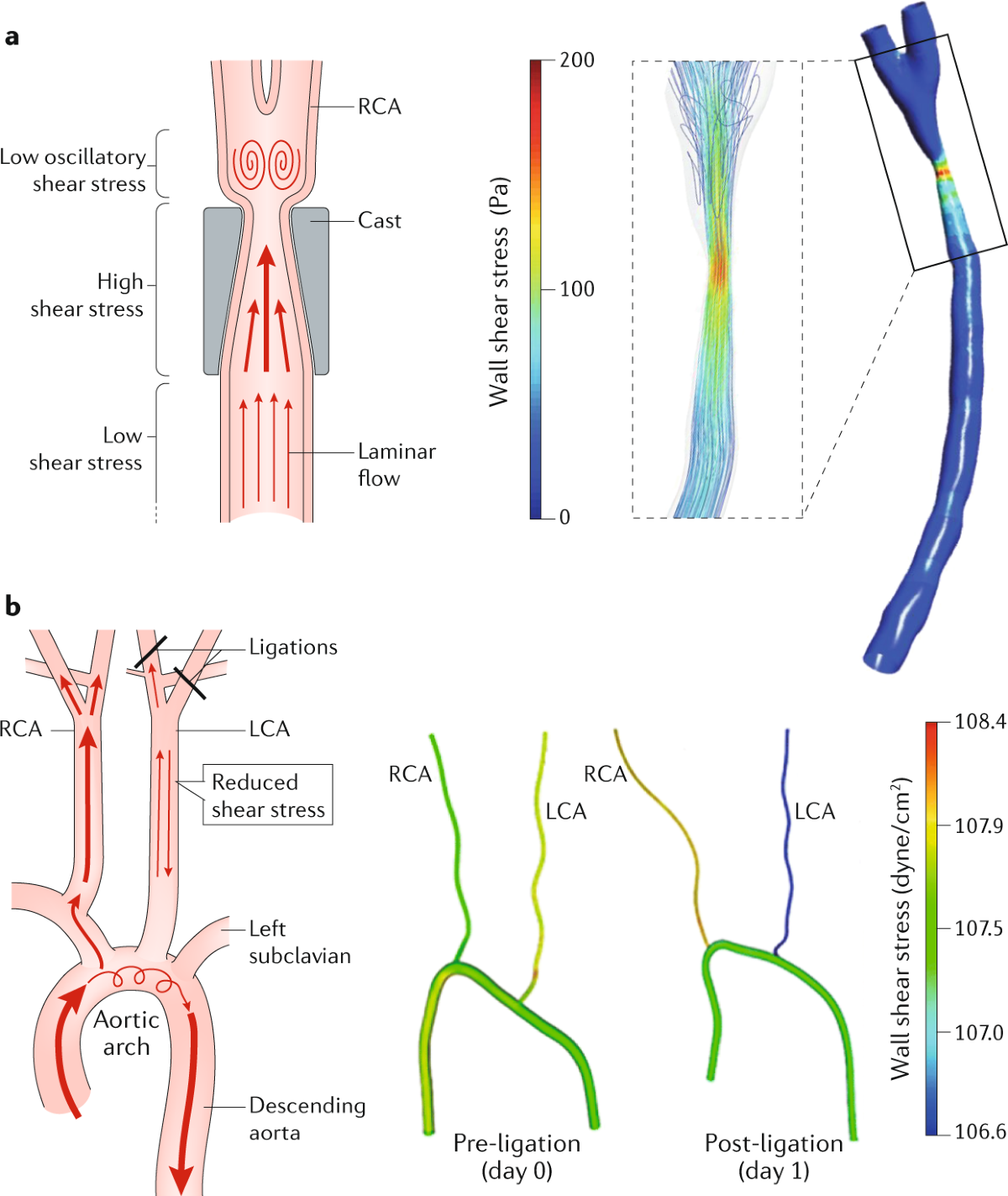 Endothelial responses to shear stress in atherosclerosis: a novel role for  developmental genes | Nature Reviews Cardiology
