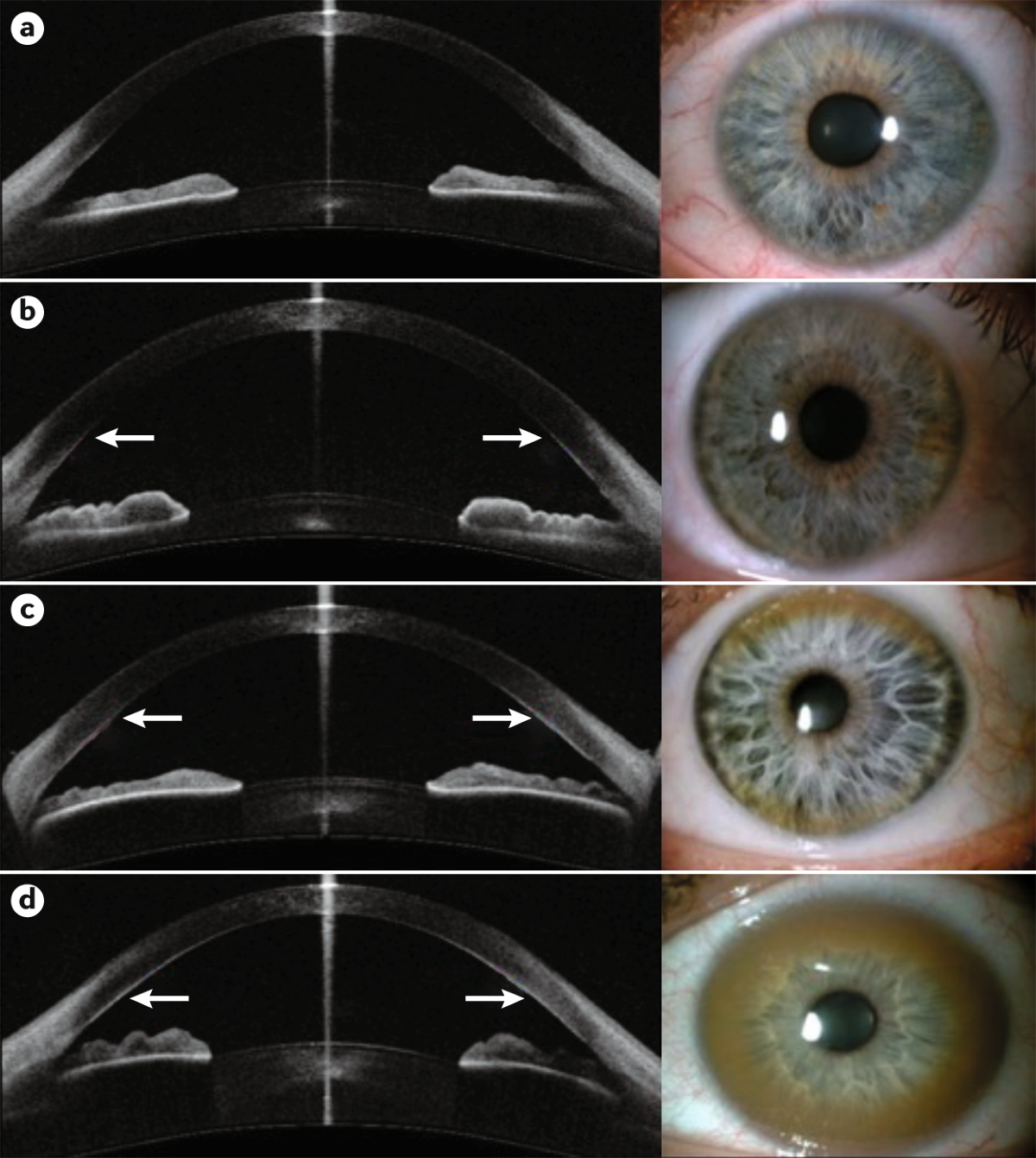 ghk-cu wilson's disease contraindication Wilson disease