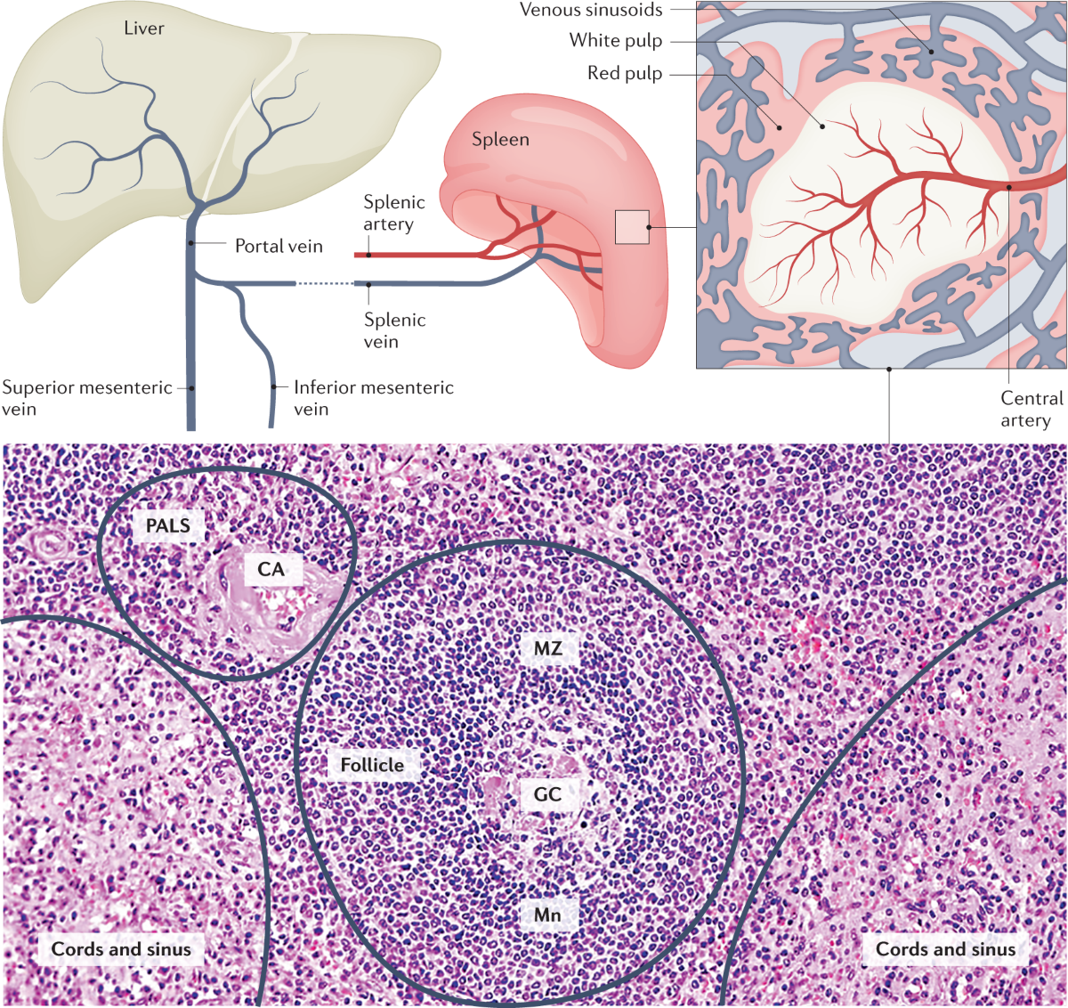 Asplenia and spleen hypofunction | Nature Reviews Disease Primers