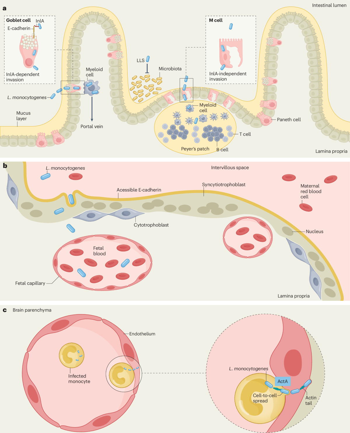 glutathione is not present in listeria Listeriosis