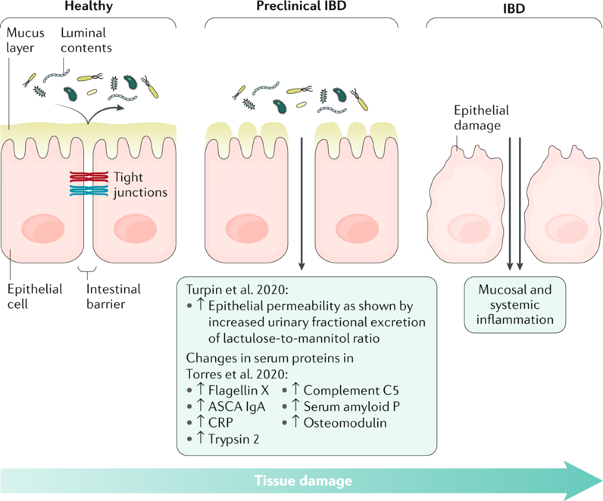 The intestinal barrier, an arbitrator turned provocateur in IBD