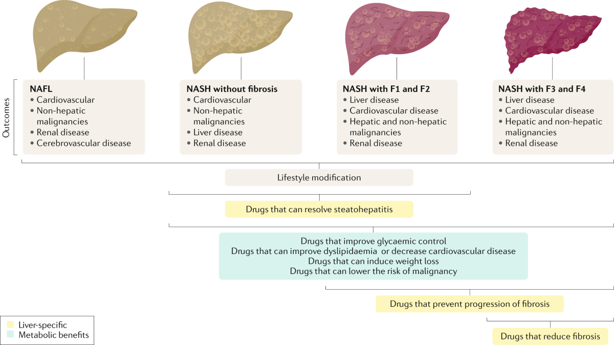 Therapeutic pipeline in nonalcoholic steatohepatitis