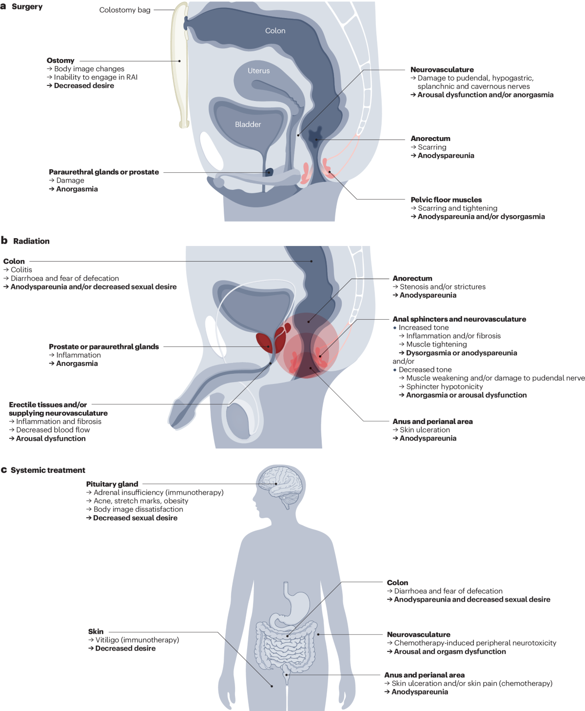 Pleasurable and problematic receptive anal intercourse and diseases of the  colon, rectum and anus | Nature Reviews Gastroenterology & Hepatology