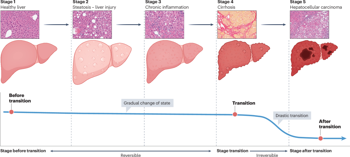 Regulated necrosis at the crossroads of liver inflammation and cancer development | Nature Reviews Gastroenterology & Hepatology Regulated necrosis at the crossroads of liver inflammation and cancer development | Nature Reviews Gastroenterology & Hepatology