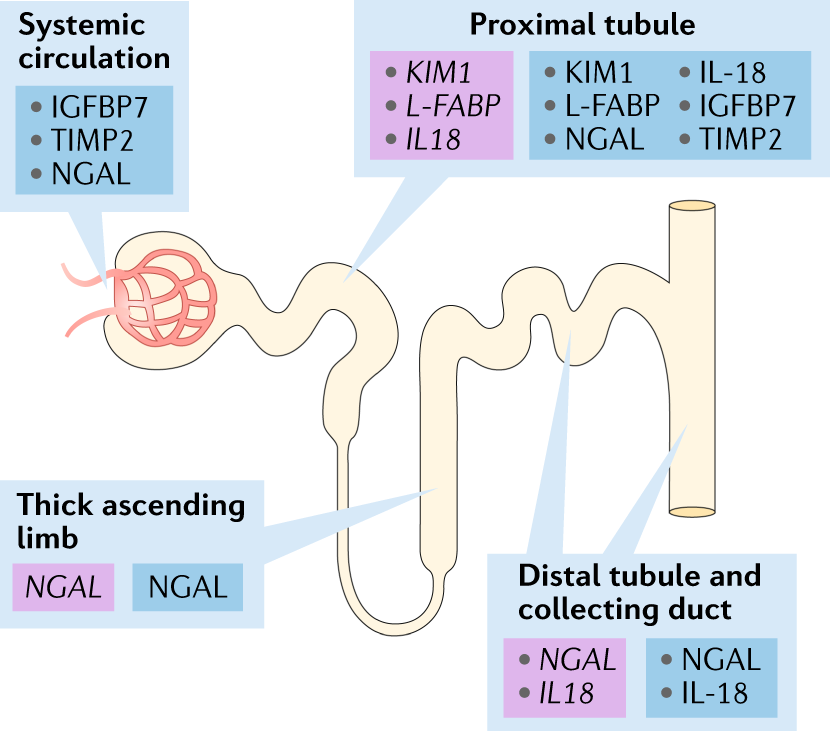 tirzepatide acute tubular injury Molecular nephrology: types of acute tubular injury