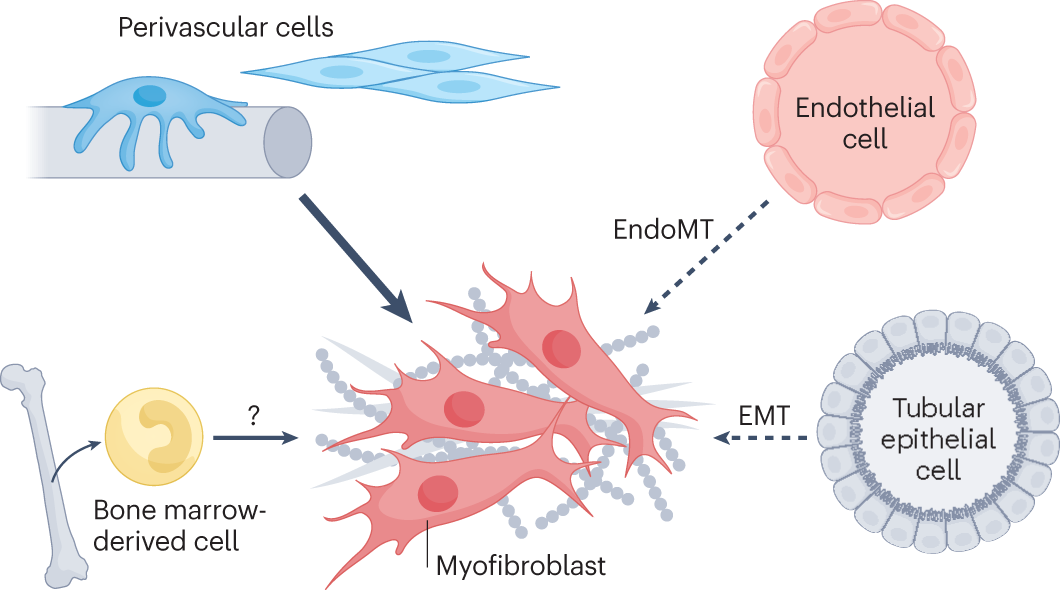 Cellular Therapy and Stem Cells for Blood Disorders

These specialized cells contribute to the repair and maintenance of blood vessel integrity, particularly important in addressing vascular complications associated with Paroxysmal Nocturnal Hemoglobinuria (PNH) and Chédiak-Higashi Syndrome [6-10].