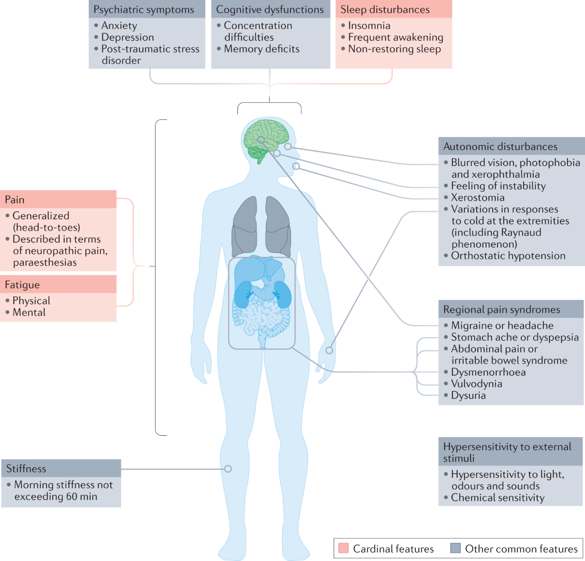 Fibromyalgia: an update on clinical characteristics, aetiopathogenesis and  treatment | Nature Reviews Rheumatology