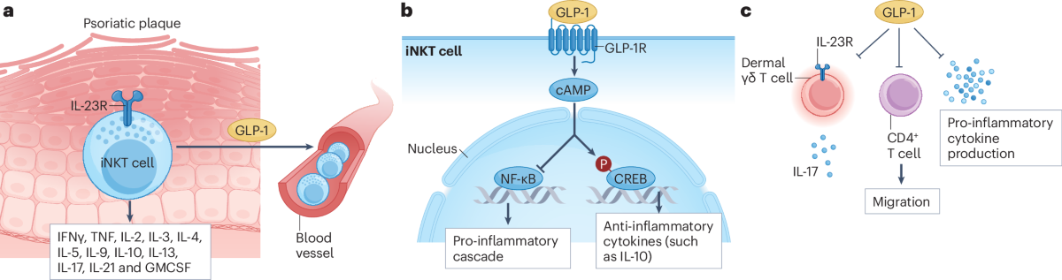 glp-1 and psoriatic arthritis The obesity–inflammation axis in psoriatic disease: mechanisms and  therapeutic strategies
