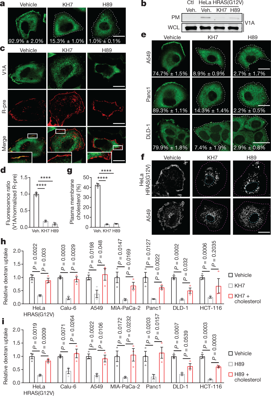 Plasma membrane V-ATPase controls oncogenic RAS-induced macropinocytosis |  Nature