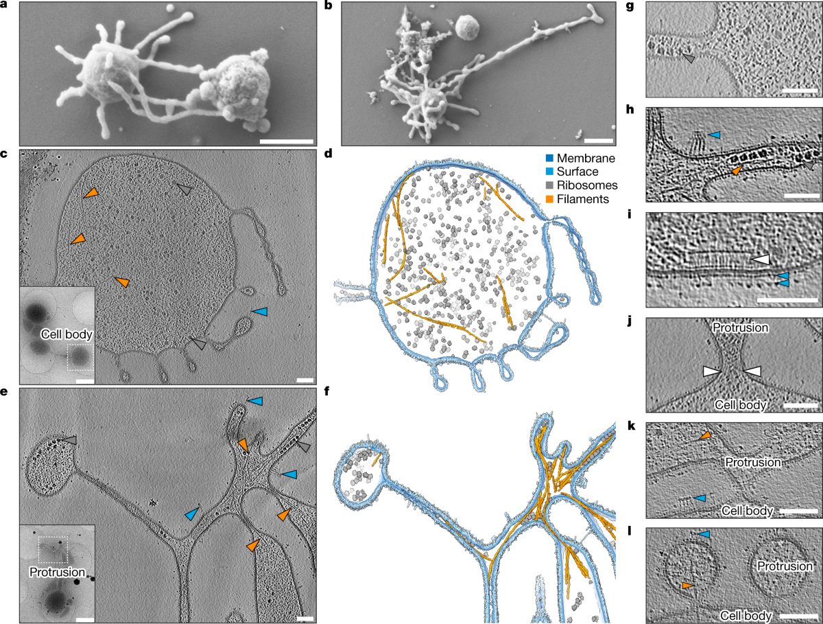 Actin cytoskeleton and complex cell architecture in an Asgard archaeon |  Nature