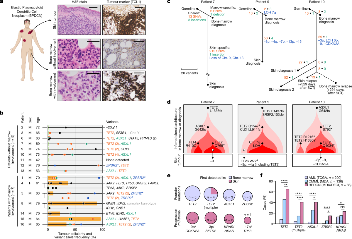 Ultraviolet radiation shapes dendritic cell leukaemia 