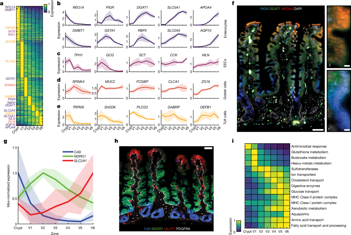 glutathione transport system in human small intestine epithelial cells A spatial expression atlas of the adult proximal Flavor:Chocolate Mint Rejuven8 Aesthetics & Training fabric|synthetic-leather