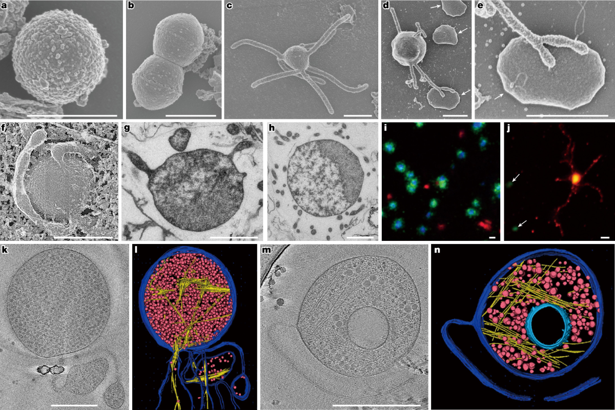 Electron and fluorescence micrographs of archaeal strain HC1: round cells, one with long branching protrusions, a cell attached to methane-producing partners, and cryo-tomograms of cell interiors with no nucleus.