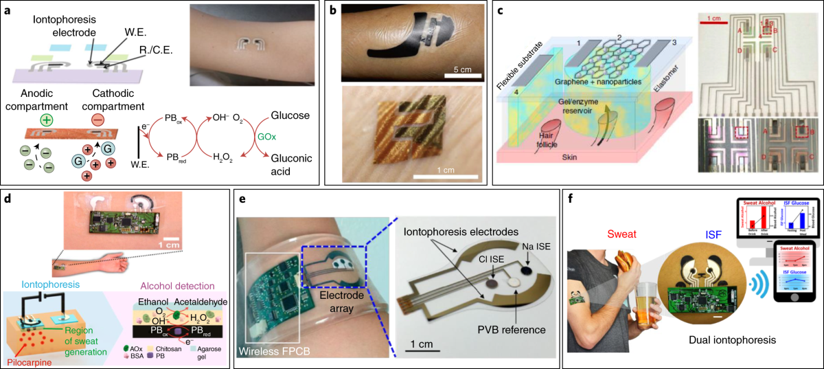 Noninvasive Diagnosis of Chronic Exertional Compartment Syndrome -  Implantable Biosensing Laboratory