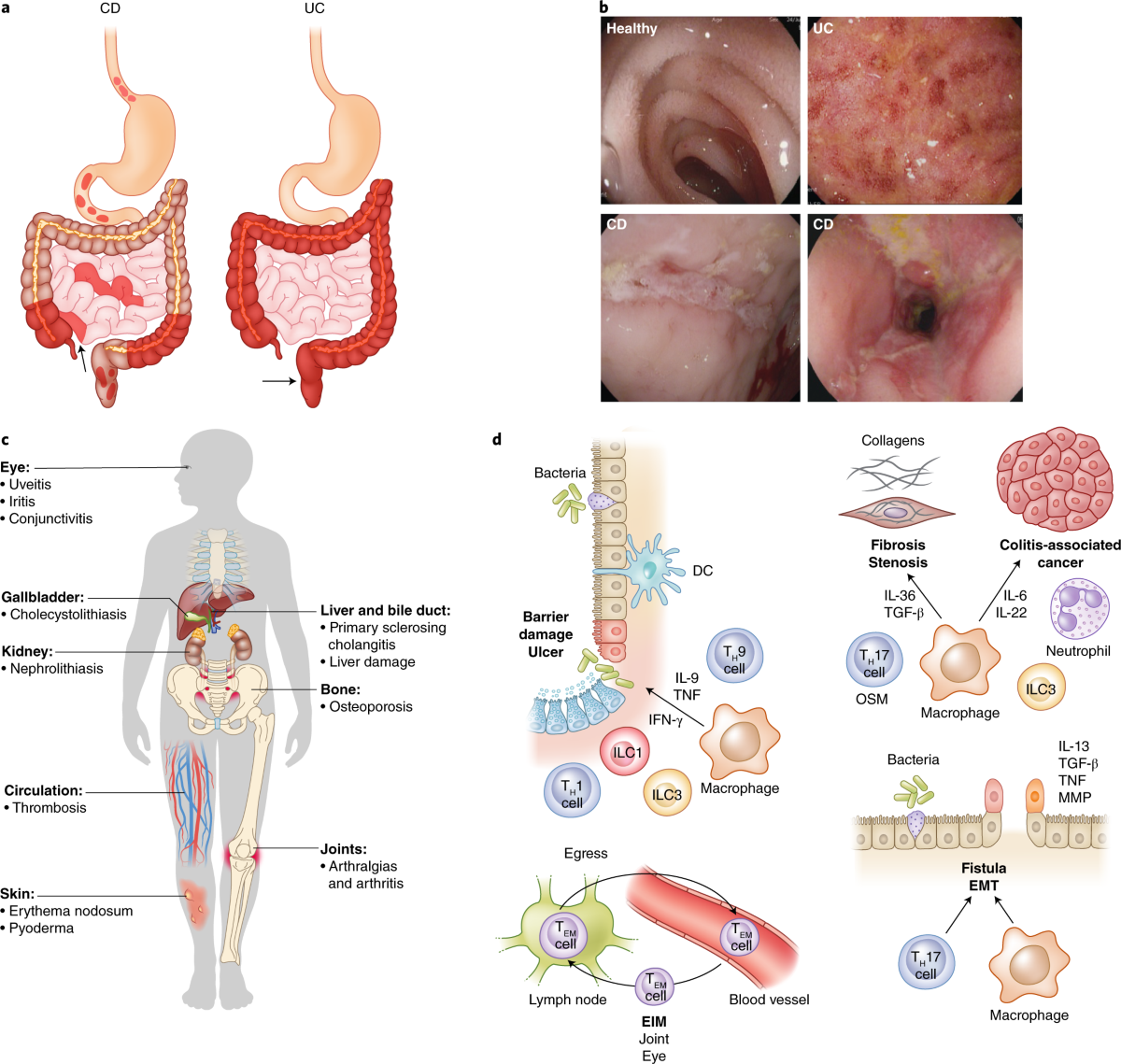 Targeting immune cell circuits and trafficking in inflammatory bowel disease 