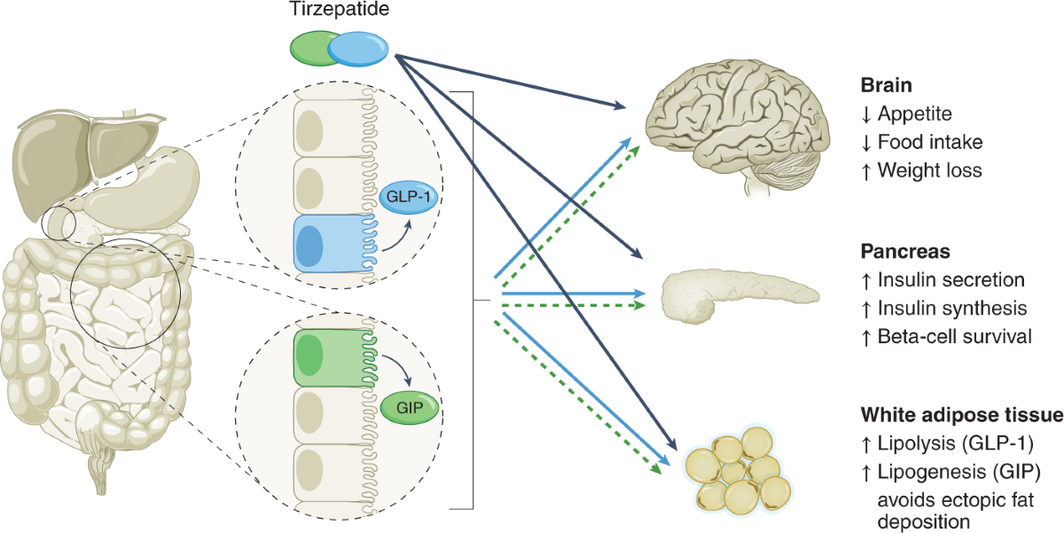 Tirzepatide for diabetes: on track to SURPASS current therapy