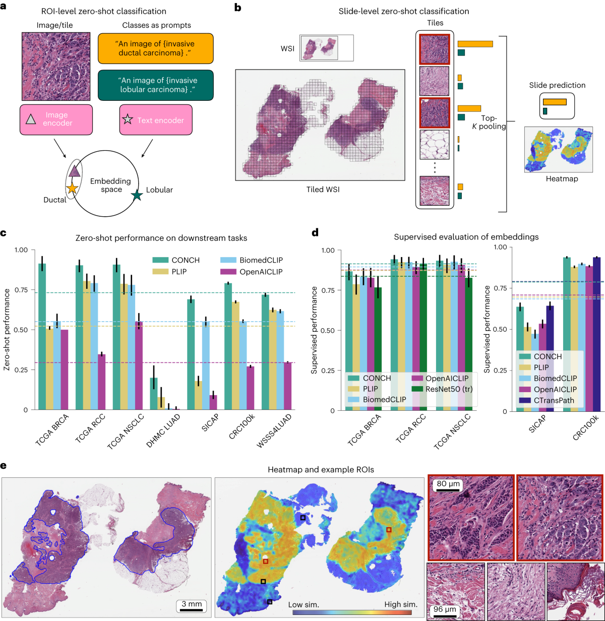 A visual-language foundation model for computational pathology 