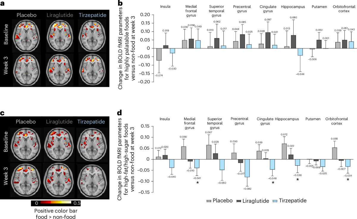 Tirzepatide on ingestive behavior in adults with overweight or obesity: a  randomized 6-week phase 1 trial