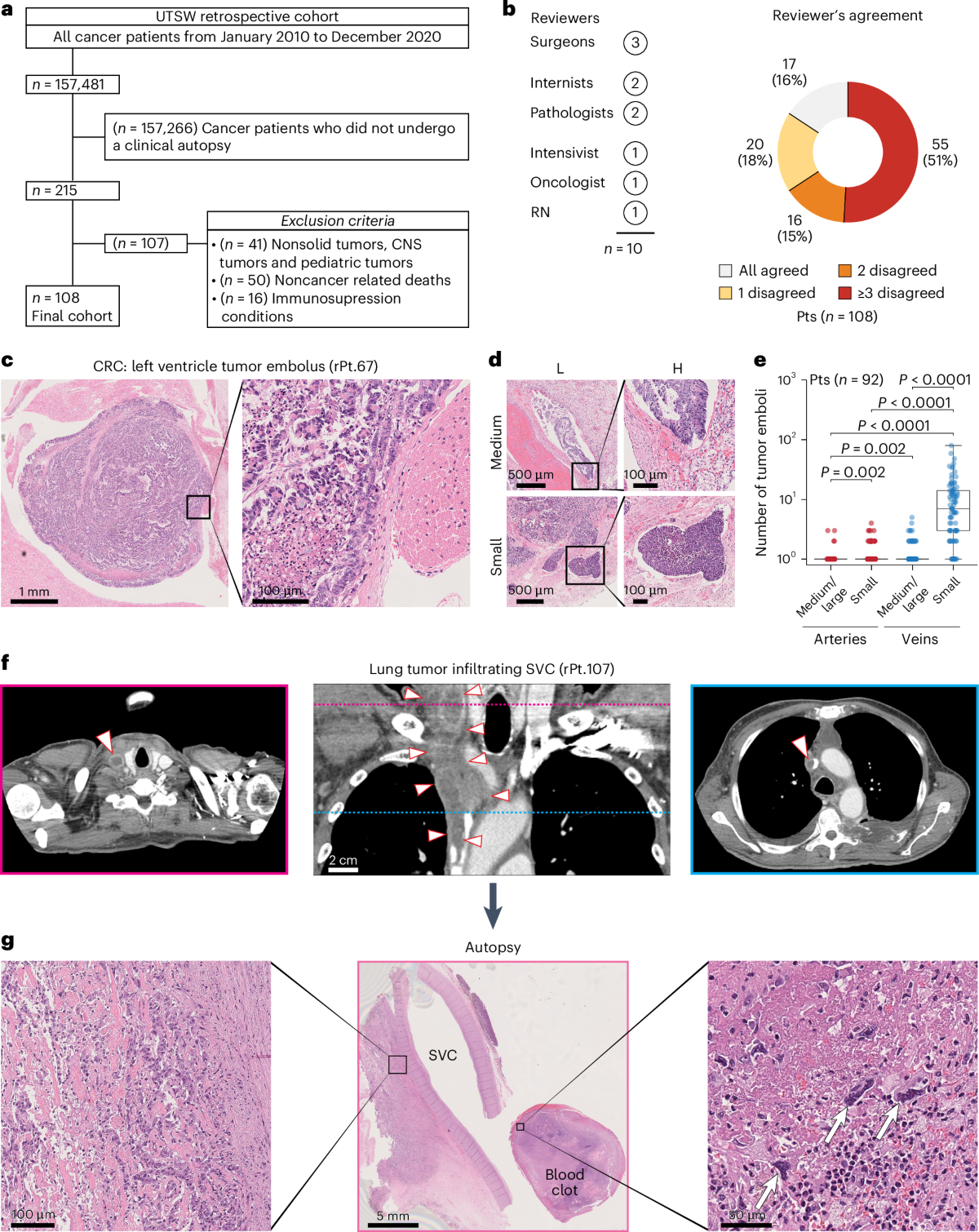 Macrovascular tumor infiltration and circulating tumor cell cluster  dynamics in patients with cancer approaching the end of life | Nature  Medicine