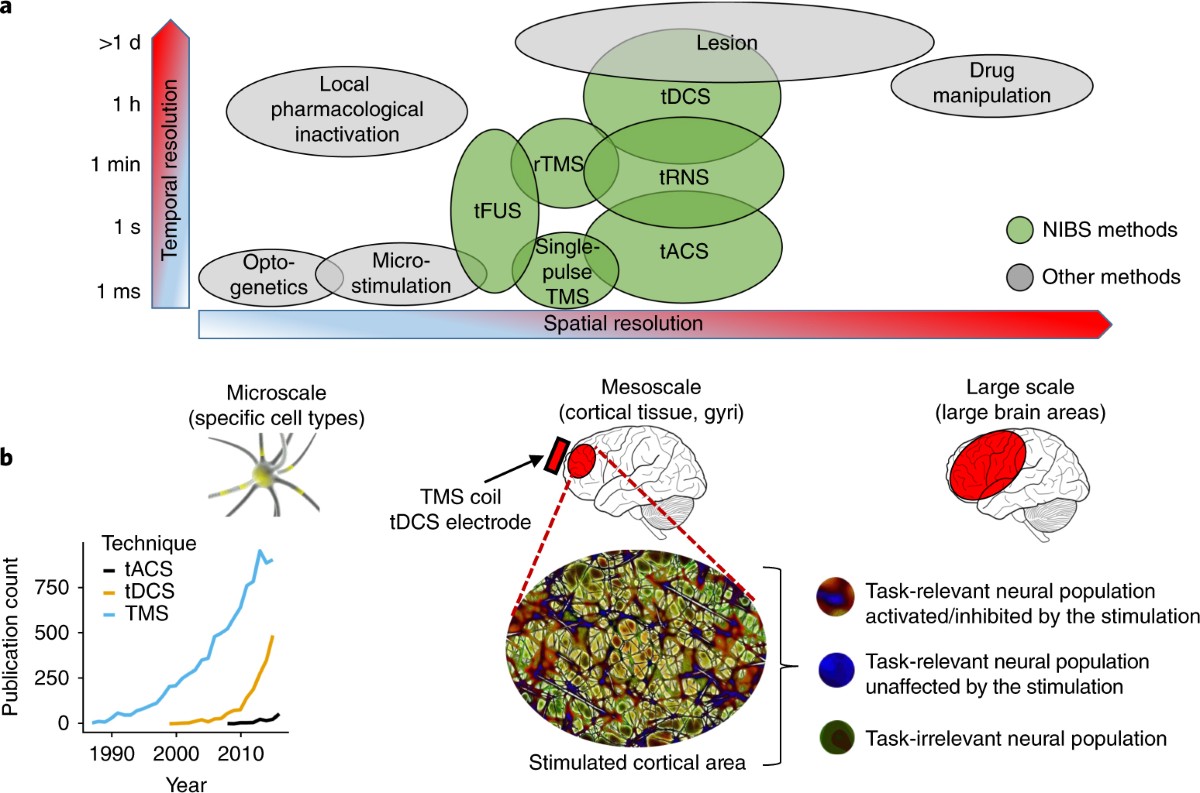 Springer tACS Neurograph