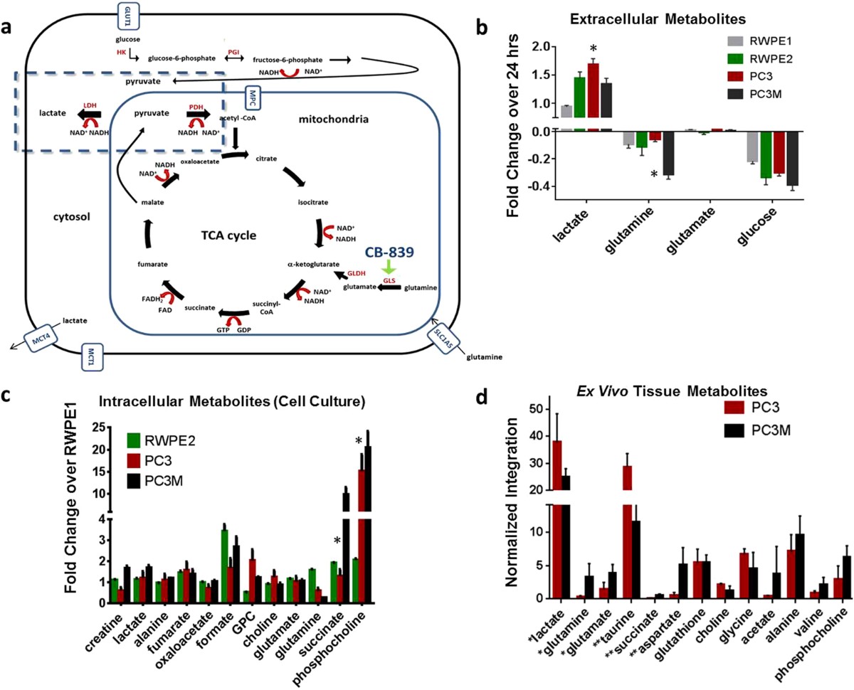 Metabolic Differences in Glutamine Utilization Lead to Metabolic  Vulnerabilities in Prostate Cancer