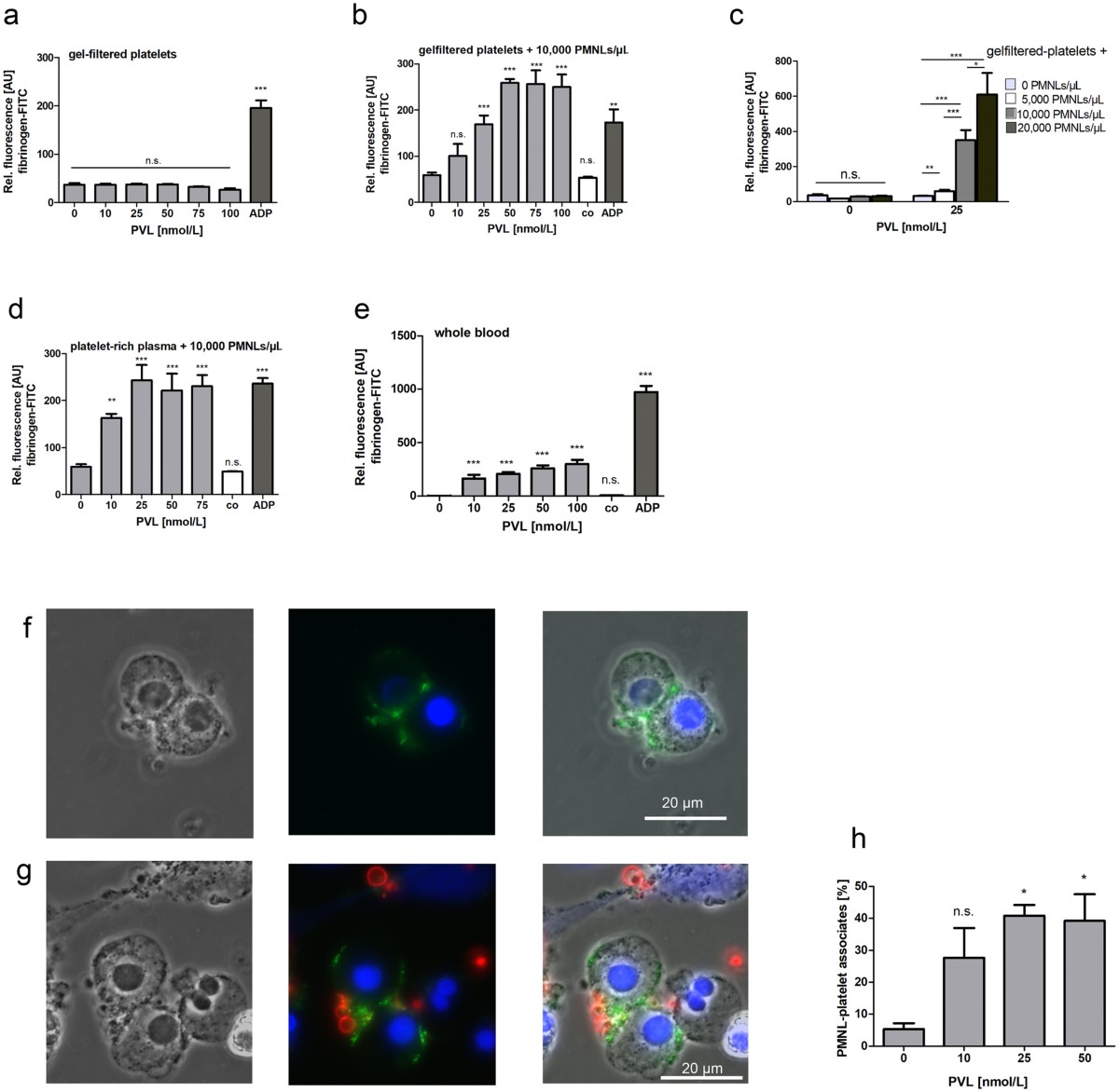 Panton-Valentine Leukocidin associated with S. aureus osteomyelitis activates platelets via neutrophil secretion products