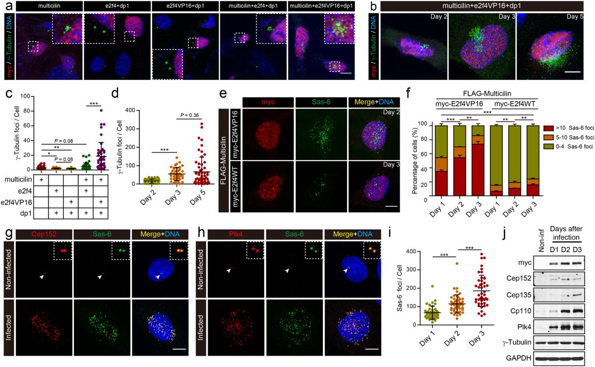 Multicilin and activated E2f4 induce multiciliated cell differentiation in primary fibroblasts | Scientific Reports multicilin-and-activated-e2f4-induce-multiciliated-cell-differentiation-in-primary-fibroblasts-scientific-reports