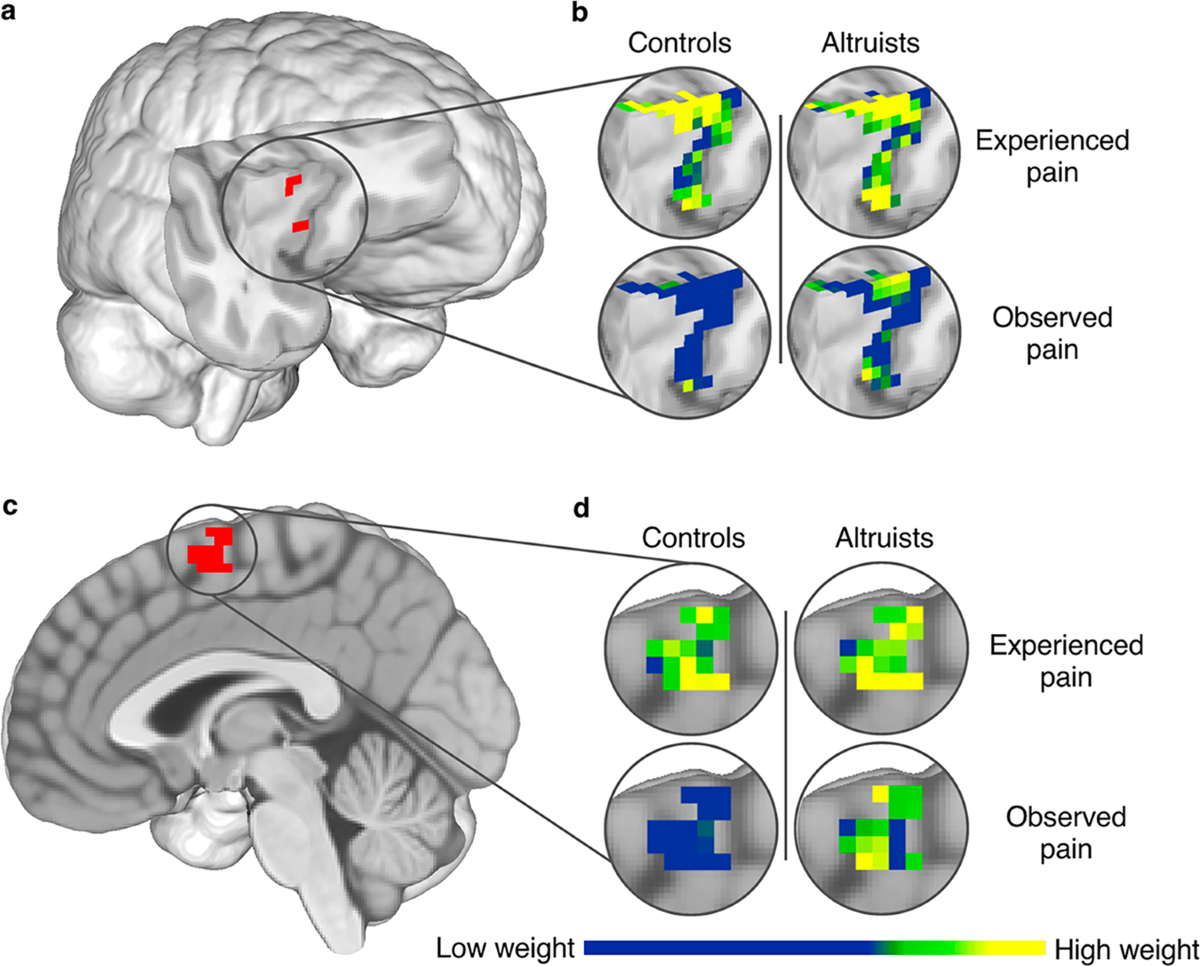 Increased similarity of neural responses to experienced and empathic  distress in costly altruism | Scientific Reports