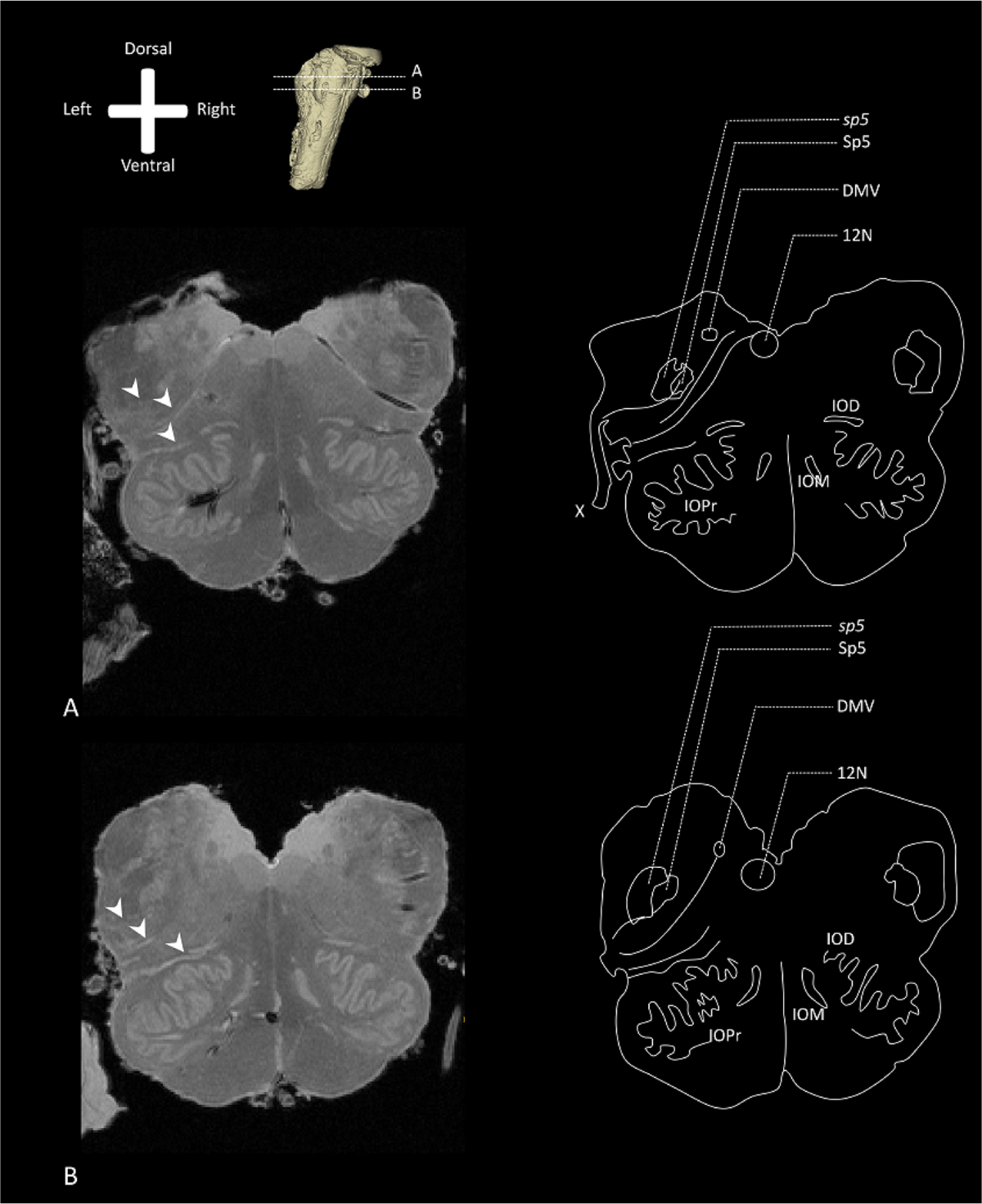Visualizing the trigeminovagal complex in the human medulla by combining  ex-vivo ultra-high resolution structural MRI and polarized light imaging  microscopy | Scientific Reports, image size:1200x1472