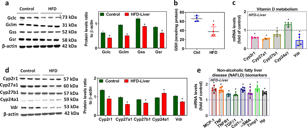 Glutathione deficiency induces epigenetic alterations of vitamin D metabolism genes in the livers of high-fat diet-fed obese mice | Scientific Reports Glutathione deficiency induces epigenetic alterations of vitamin D metabolism genes in the livers of high-fat diet-fed obese mice | Scientific Reports