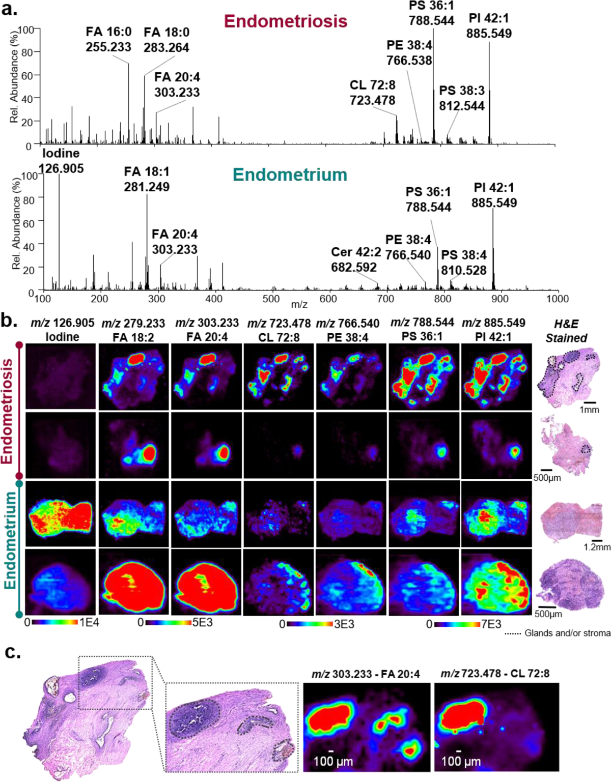 Molecular Imaging of Endometriosis Tissues using Desorption Electrospray  Ionization Mass Spectrometry | Scientific Reports