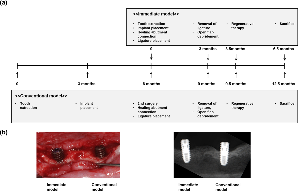 Comparison of experimental peri-implantitis models after application of ex  vivo BMP2 gene therapy using periodontal ligament stem cells | Scientific  Reports, image size:1200x769