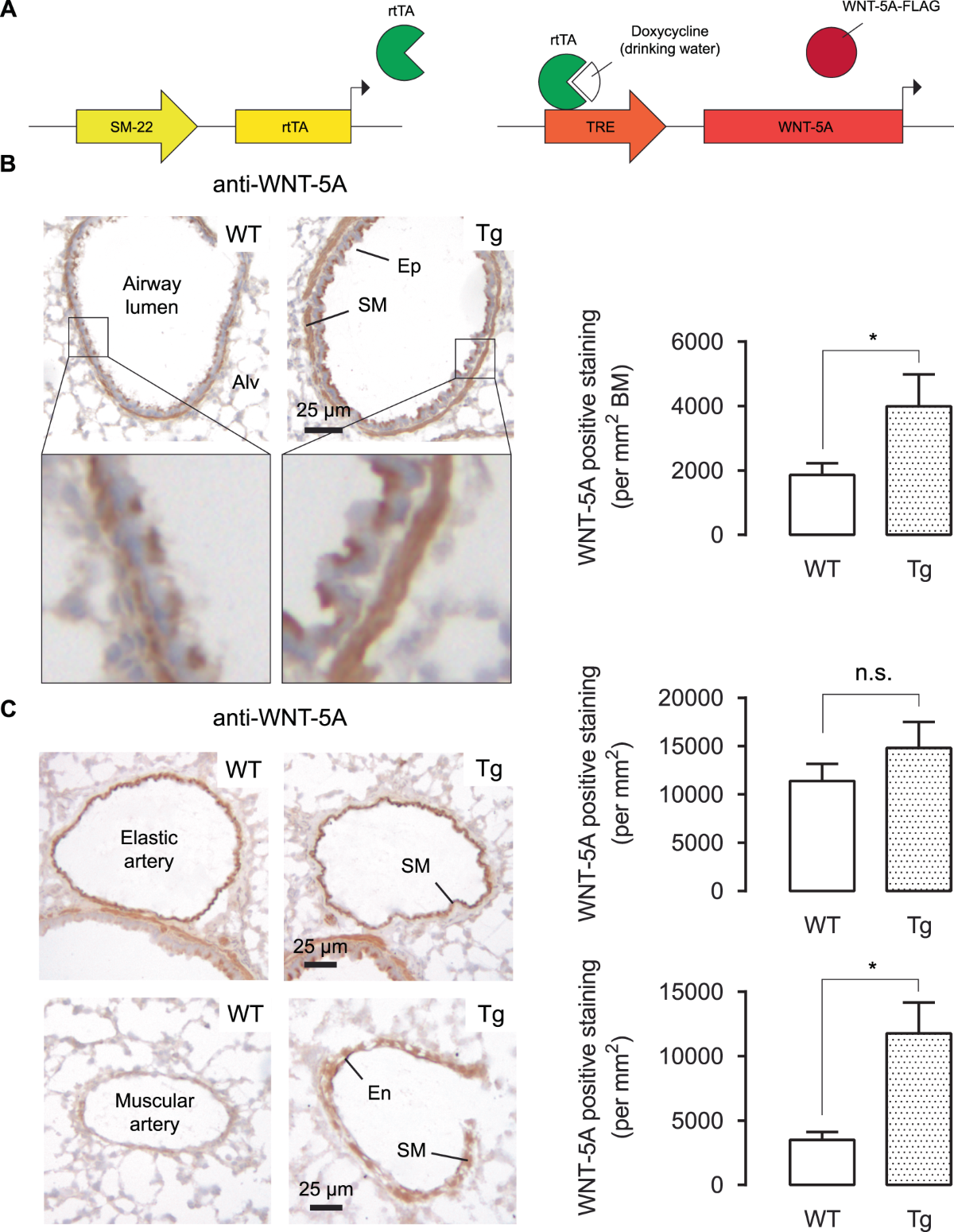 Smooth-muscle-derived WNT5A augments allergen-induced airway remodelling  and Th2 type inflammation | Scientific Reports