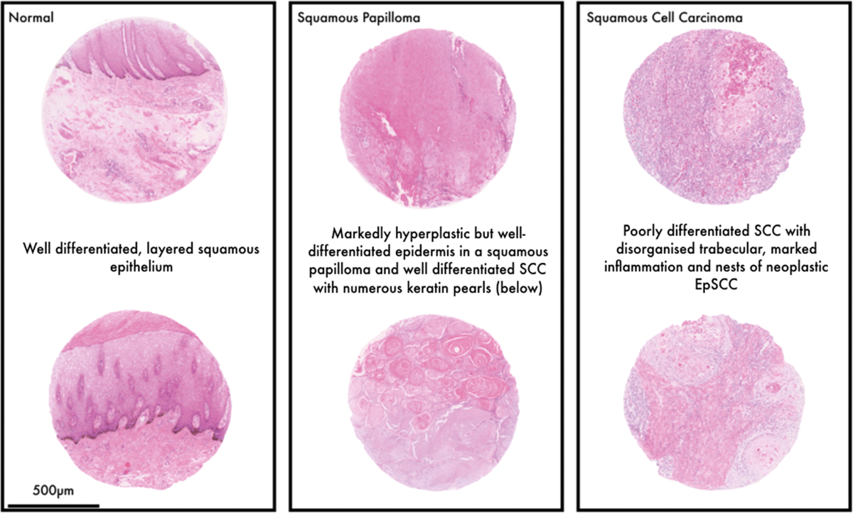 Equine penile squamous cell carcinoma: expression of biomarker proteins and  EcPV2 | Scientific Reports