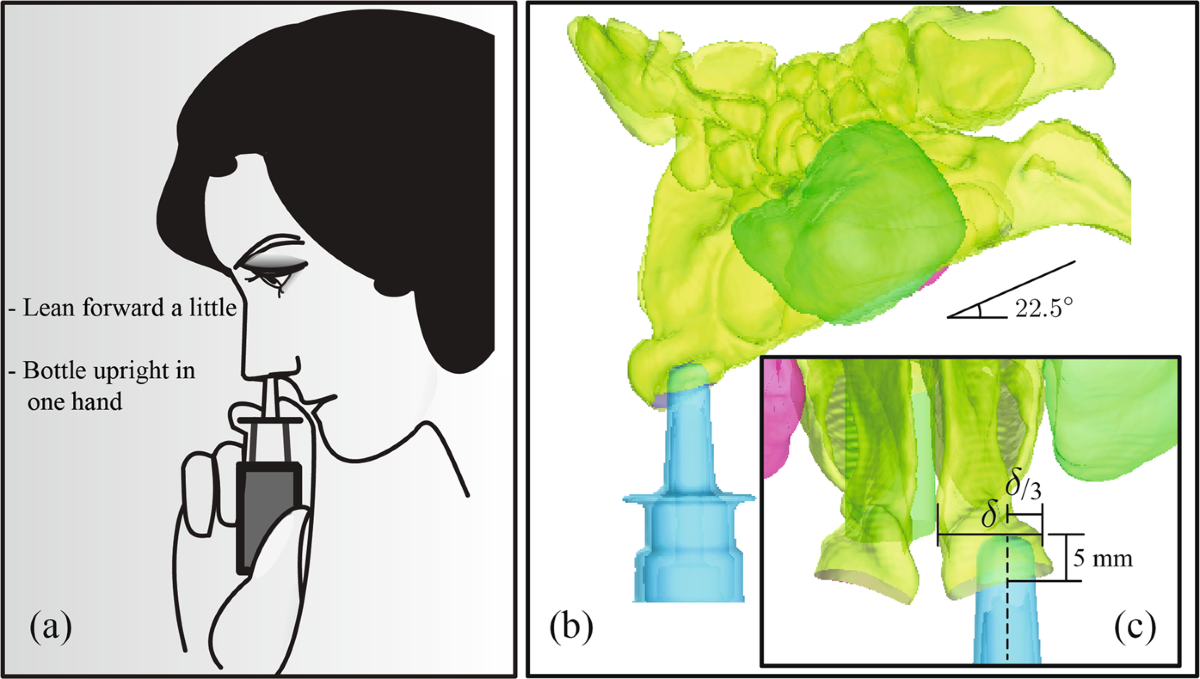 Numerical evaluation of spray position for improved nasal drug delivery | Scientific Reports Numerical evaluation of spray position for improved nasal drug delivery | Scientific Reports