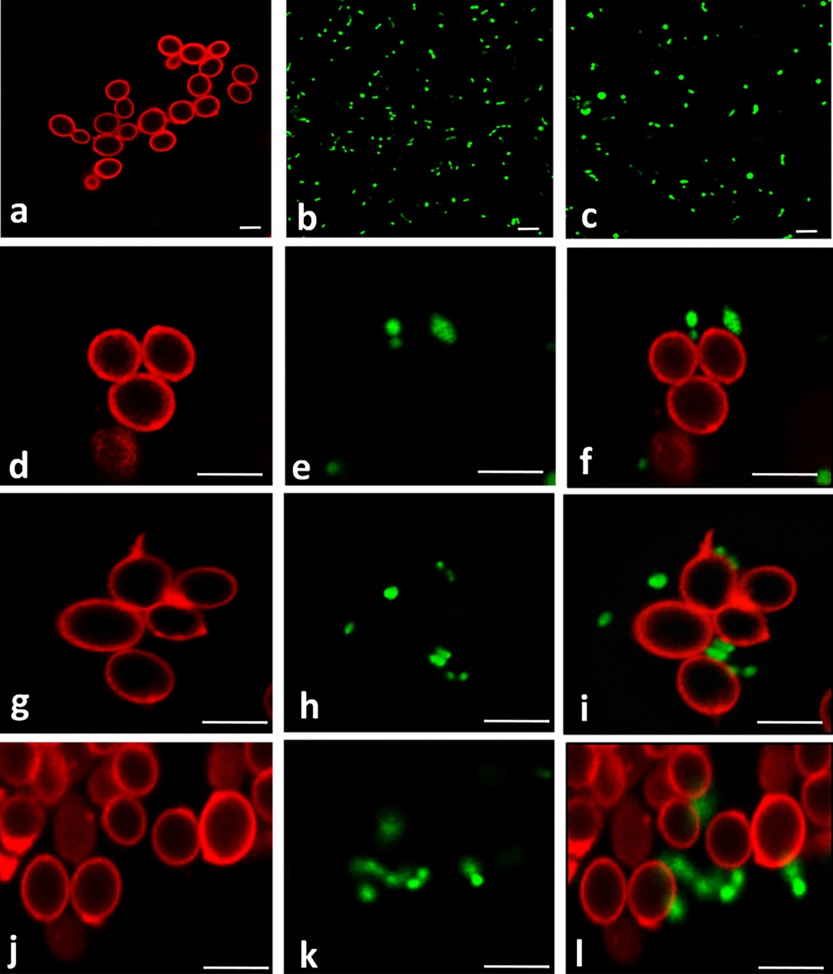 Bacteroides thetaiotaomicron and Lactobacillus johnsonii modulate  intestinal inflammation and eliminate fungi via enzymatic hydrolysis of the  fungal cell wall | Scientific Reports
